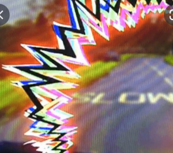 Ocular Migraine